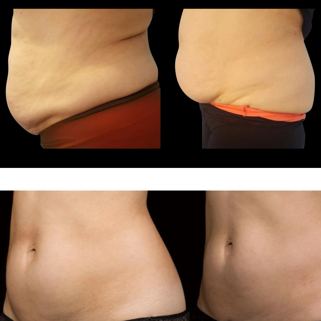 ERIS Lipo Cavitation Machine 6 in 1 Professional | Powerful Fat ERIS Lipo Cavitation Machine 6 in 1 Professional | Powerful Fat